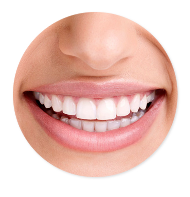 Diseño de sonrisa - Vibart Dental clinic