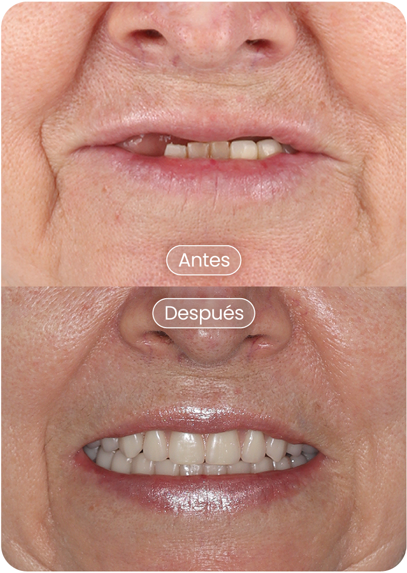 Ines-Odilia-Monsalve-Suarez