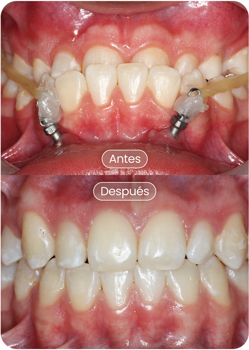 Laura-Valentina-Cortez-Ossa