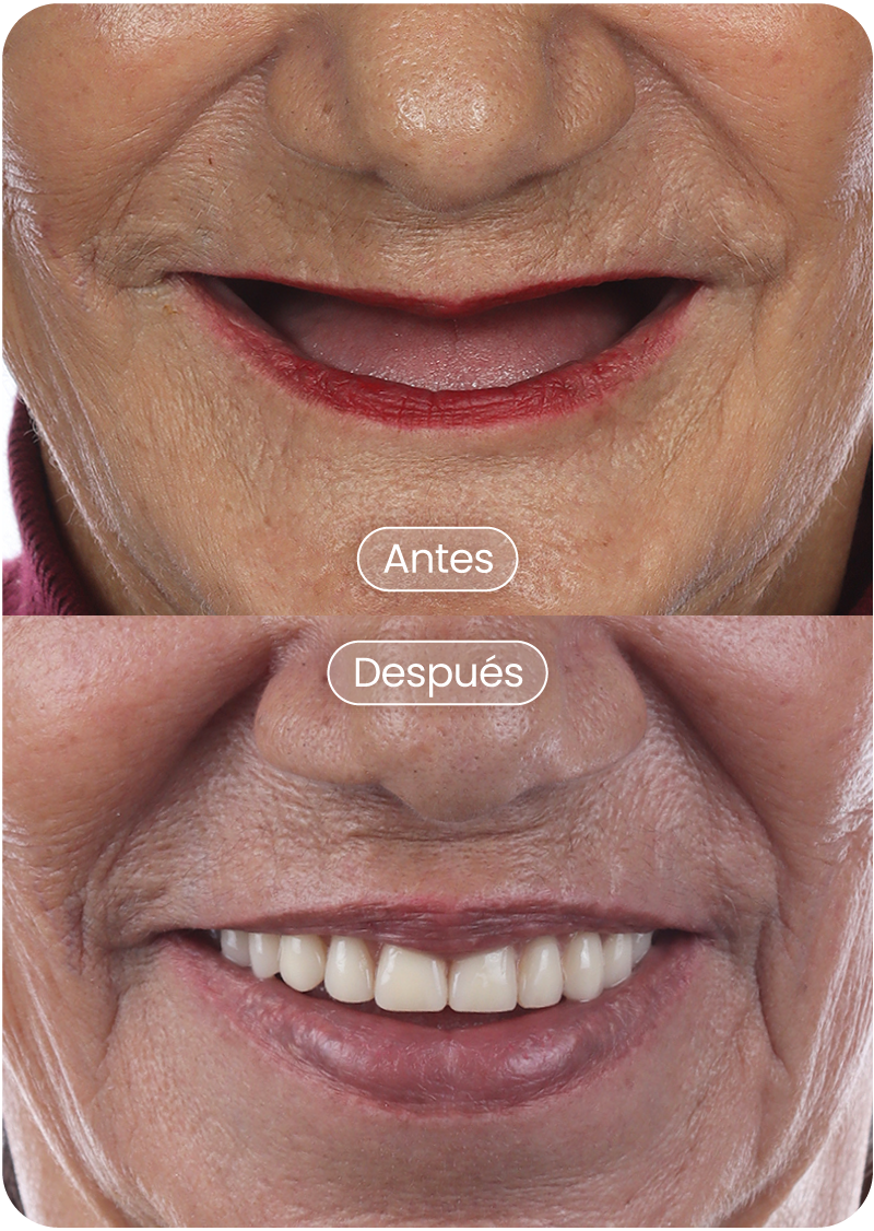 Marleny-Lozano-De-Restrepo