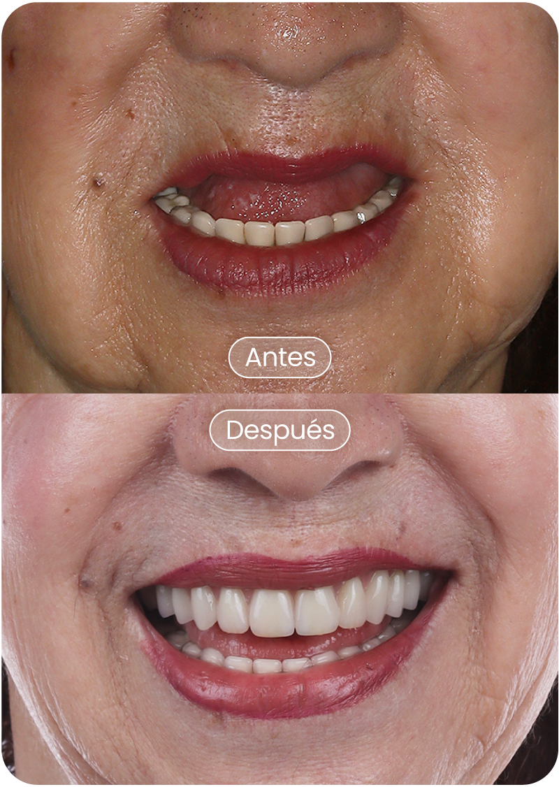 Ruth-Mery-Alzate-Franco