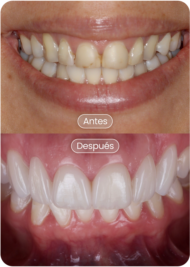 DISEÑO-DE-SONRISA